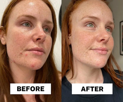 Pure Glow Set (7 pc set)™