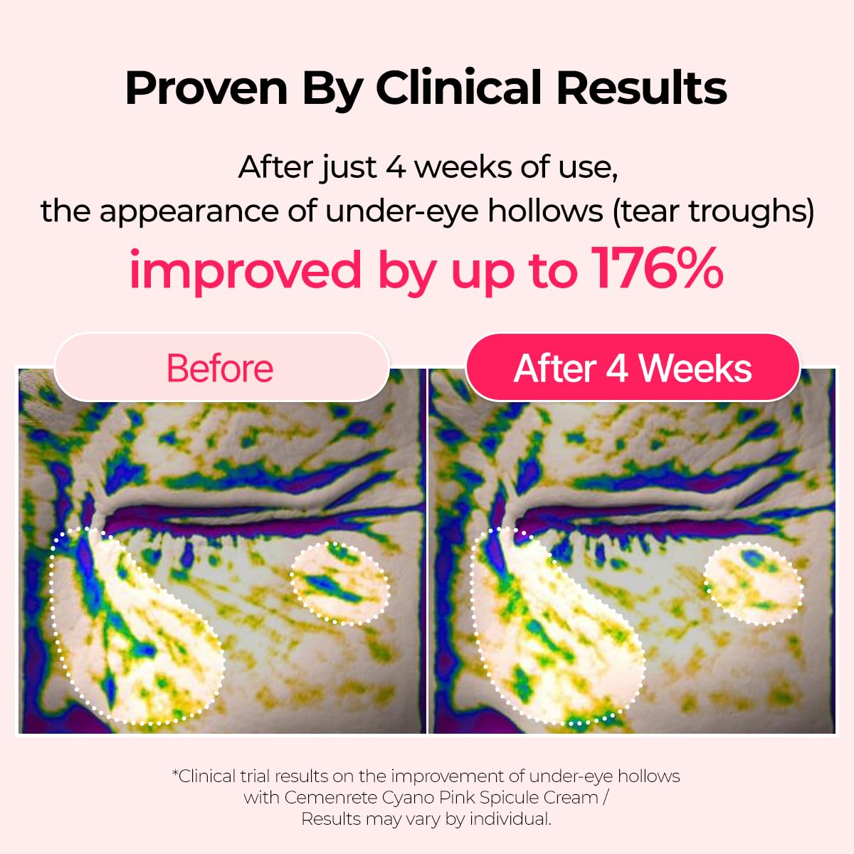 Collagen Boost (5pc Set)™