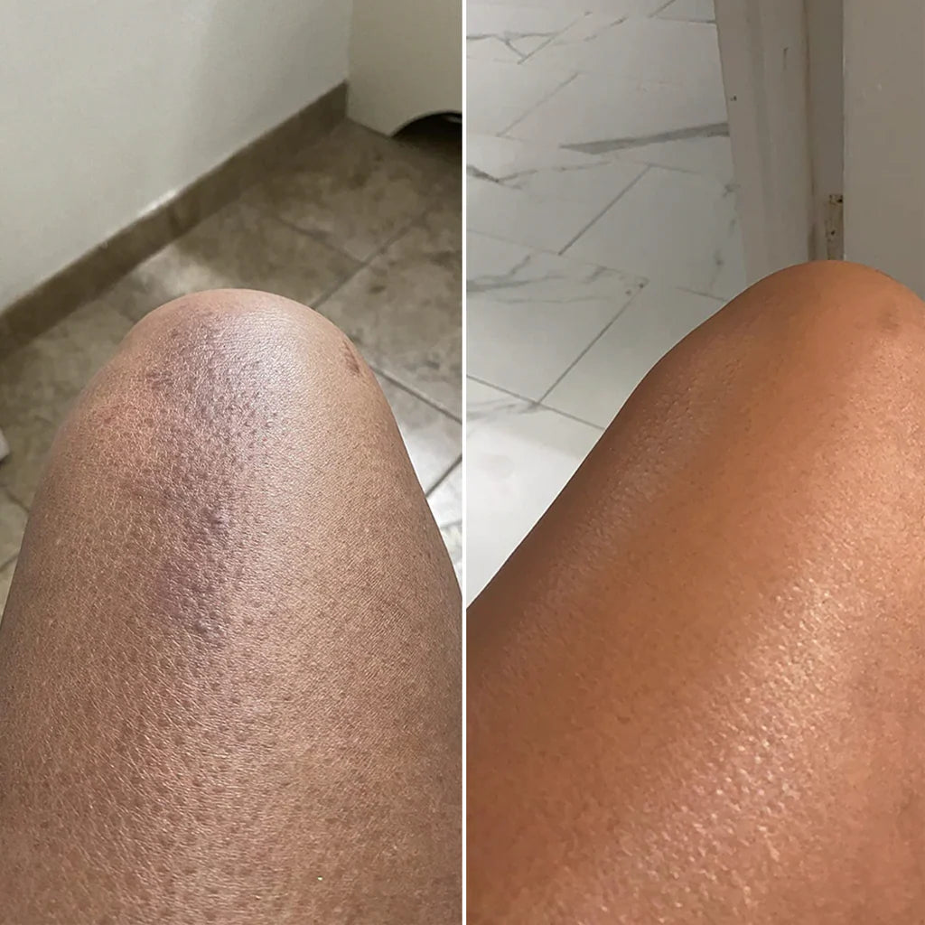 <strong>✨ Fade the Spots. Reveal Your True Glow</strong>